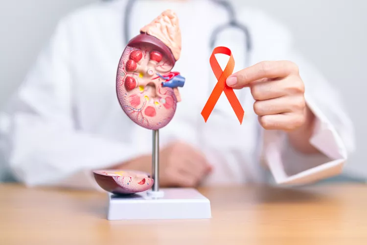 Foto principal de Cáncer de riñón