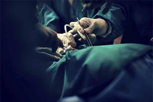 Cirugía de la hernia umbilical